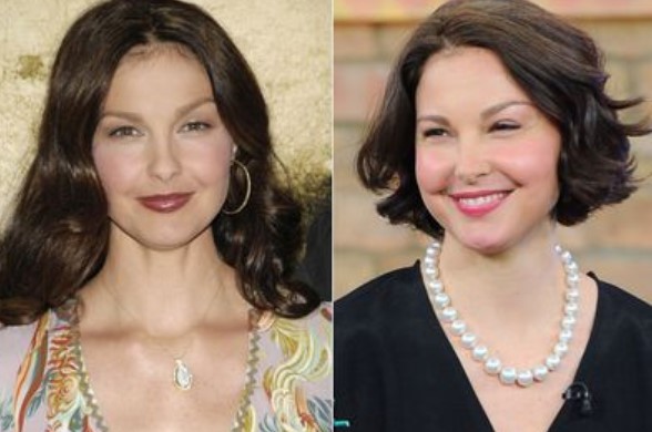 Ashley Judd Plastic Surgery