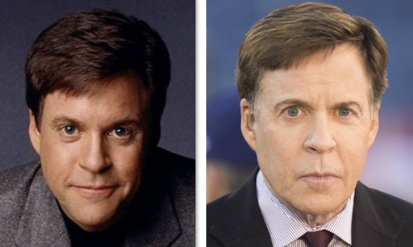 Bob Costas Plastic Surgery