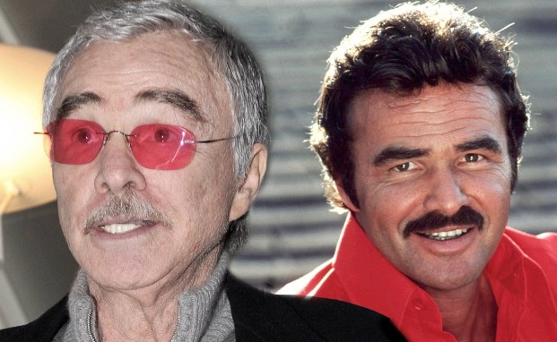 Burt Reynolds Plastic Surgery Facelift