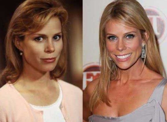 Cheryl Hines Plastic Surgery Boob Job