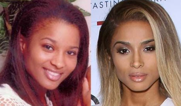 Ciara Nose Job