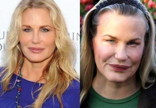 Daryl Hannah Plastic Surgery