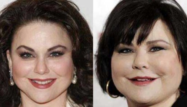 Dela Burke Plastic Surgery