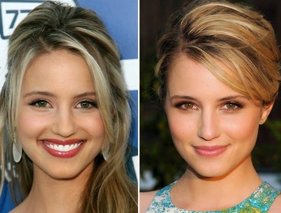 Dianna Agron Nose Job