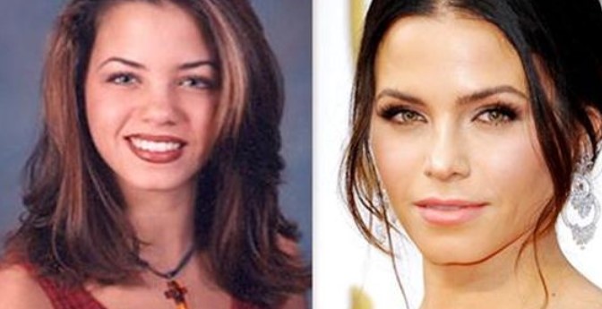 Jenna Dewan Plastic Surgery