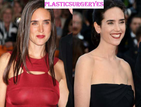 Jennifer Connelly Breast Reduction