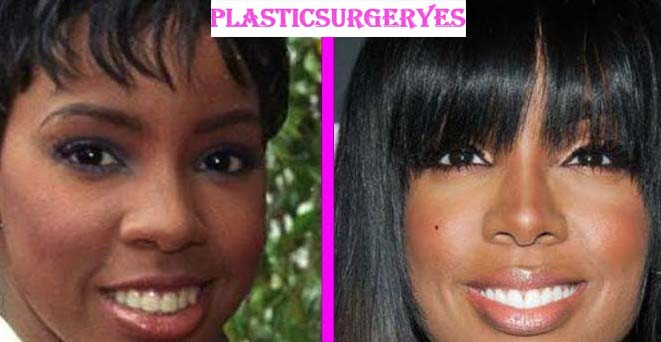 Kelly Rowland Nose Job