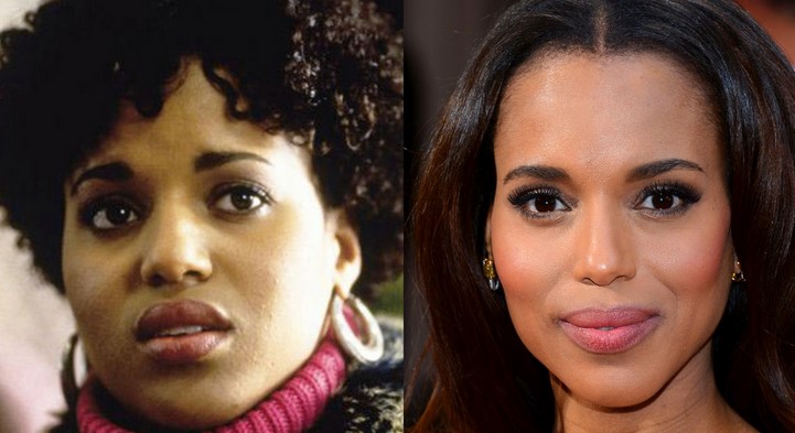 Kerry Washington Plastic Surgery