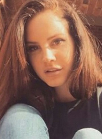 Lana Del Rey Before Plastic Surgery