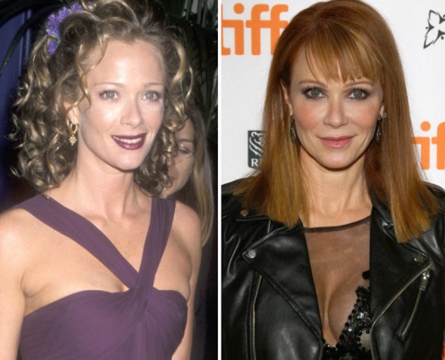 Lauren Holly Plastic Surgery Boob Job