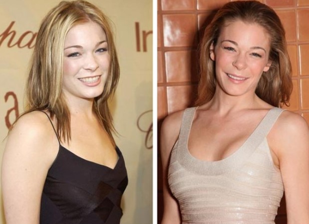 LeAnn Rimes Plastic Surgery