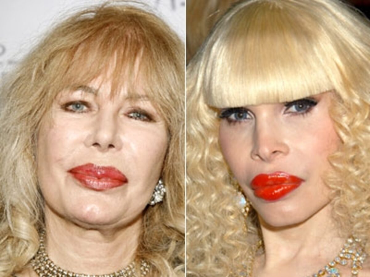 Amanda lepore before plastic surgery