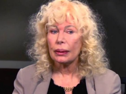 Loretta Swit Plastic Surgery