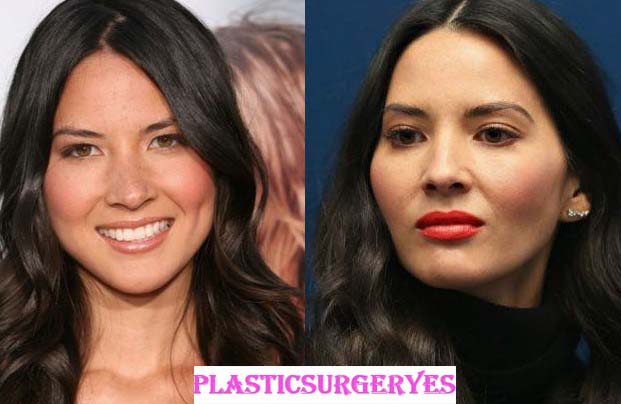 Olivia Munn Plastic Surgery