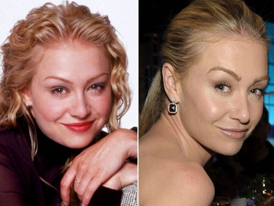 Portia de Rossi Plastic Surgery Nose Job