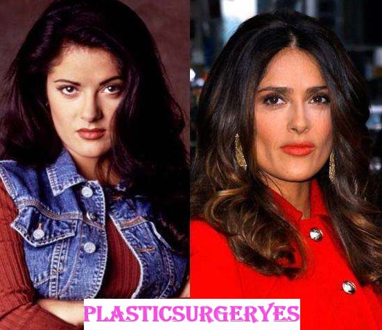 Salma Hayek Plastic Surgery