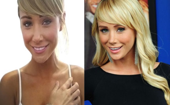 mount typisk Forvirre Sara Jean Underwood Before and After Surgery - Plastic SurgerYes