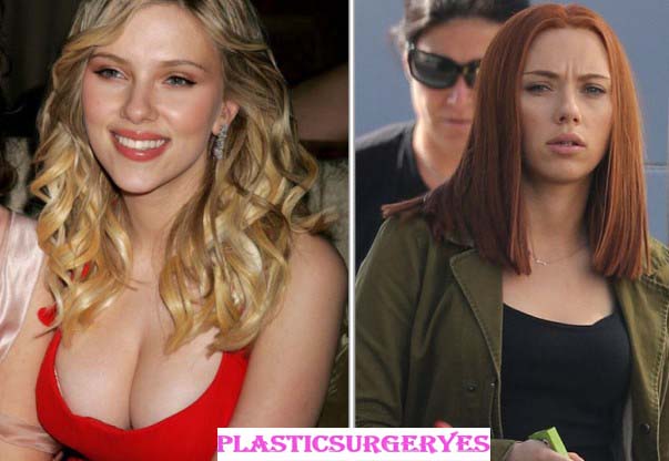 Scarlett Johansson Breast Reduction