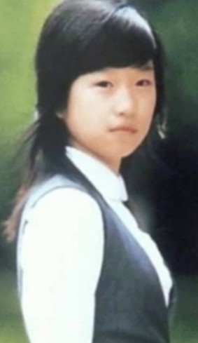 Seo Ye Ji Before Plastic Surgery