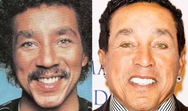 Smokey Robinson Plastic Surgery