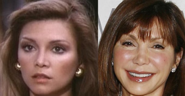 Victoria Principal Plastic Surgery