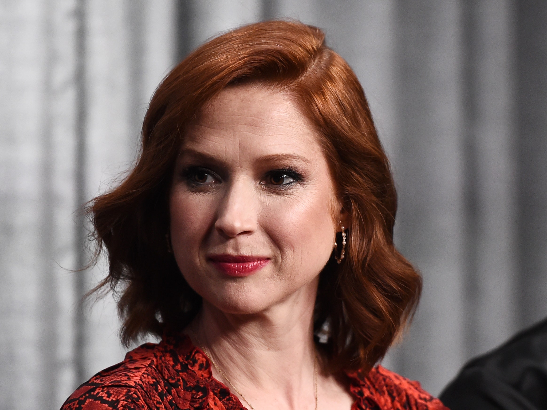 Ellie Kemper Cosmetic Surgery