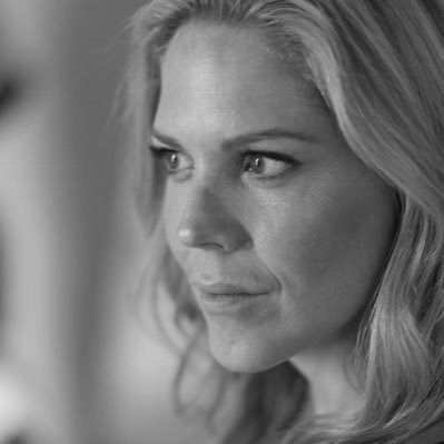 Mary McCormack Cosmetic Surgery Face