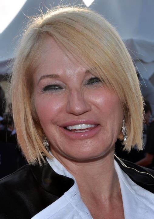 Ellen Barkin Cosmetic Surgery Face