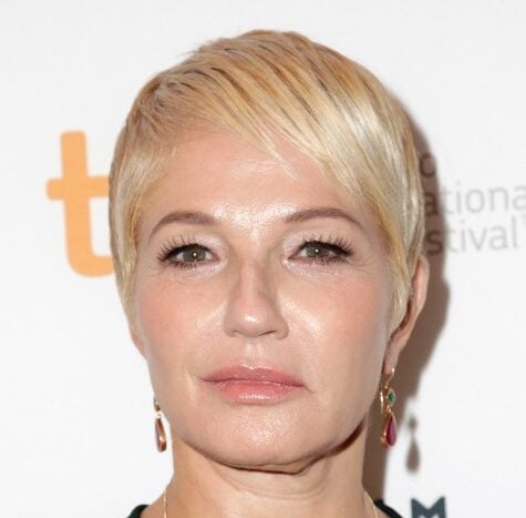 Ellen Barkin Plastic Surgery Procedures