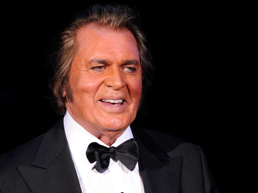 Engelbert Humperdinck Plastic Surgery Face