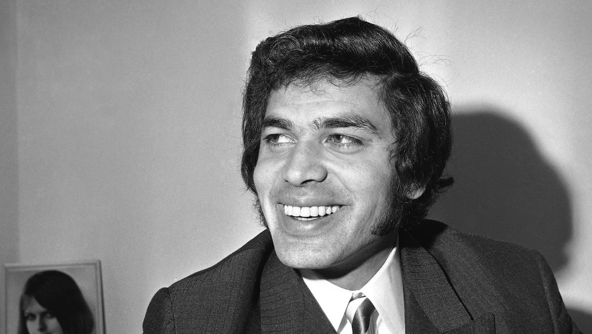 Engelbert Humperdinck Plastic Surgery