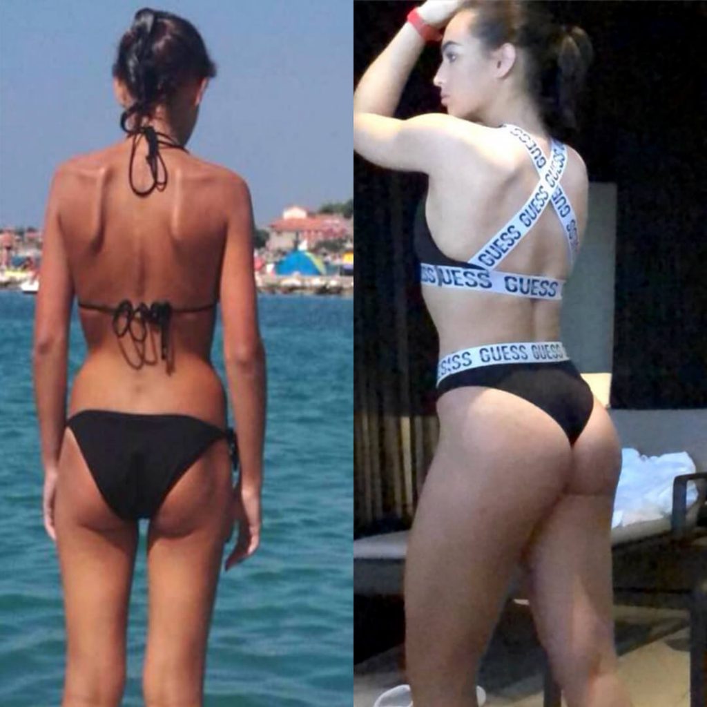 Jen Selter Plastic Surgery Body