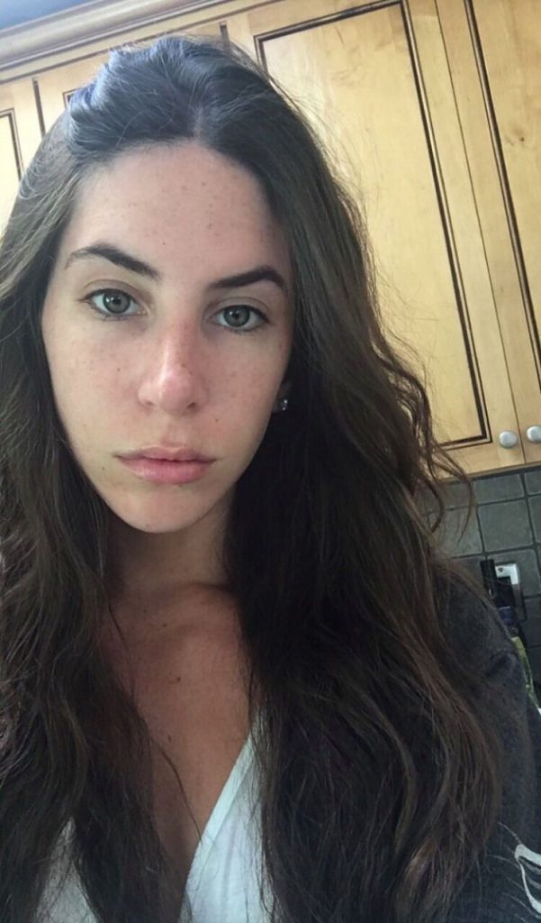 Jen Selter Plastic Surgery Face