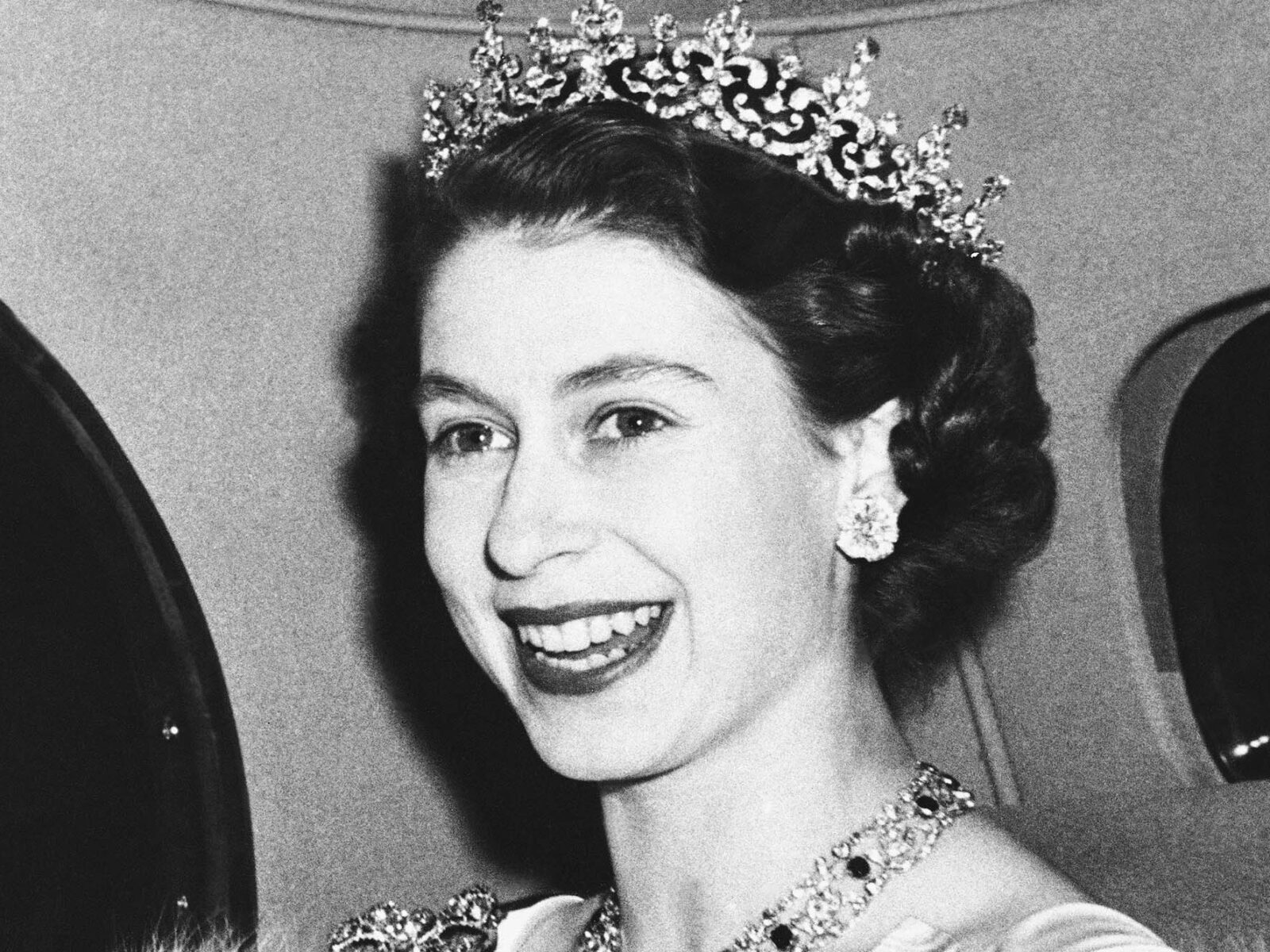 Queen Elizabeth Plastic Surgery