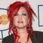Cyndi Lauper Plastic Surgery Procedures