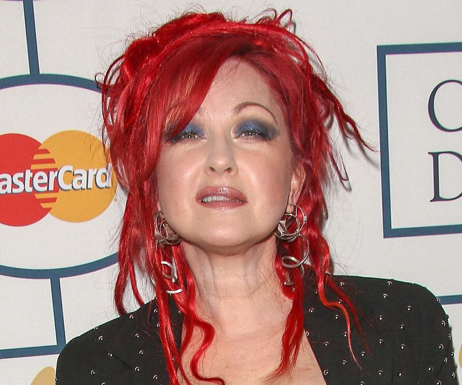 Cyndi Lauper Plastic Surgery Procedures